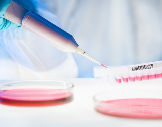 IPA Syngeneic Cell Line